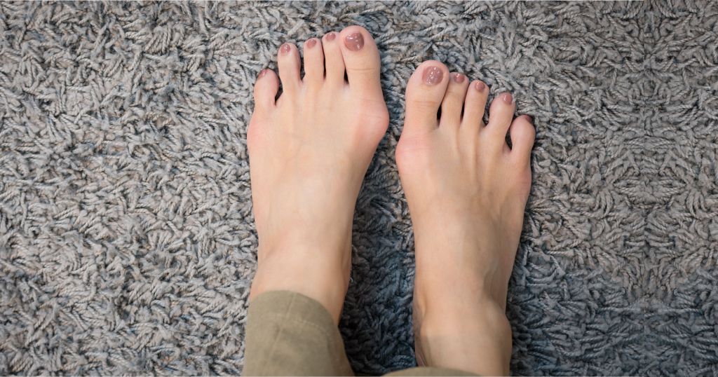 Spreizfuss Hallux Füße auf Teppich
